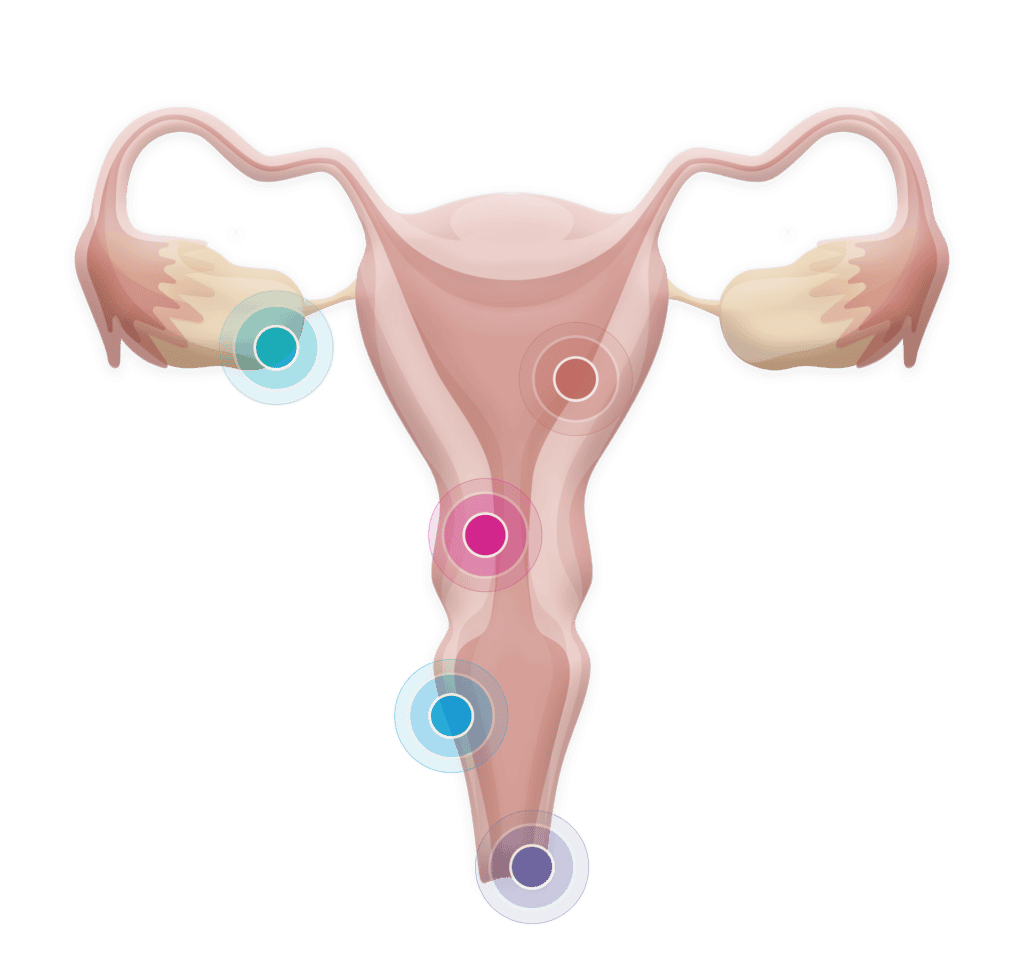Illustrazione tumori
